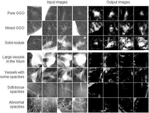 Computerized Detection of Lung Nodules in Low-Dose CT, Part II: Usefulness of Multiple Massive-Training Artificial Neural Networks (Multi-MTANNs)