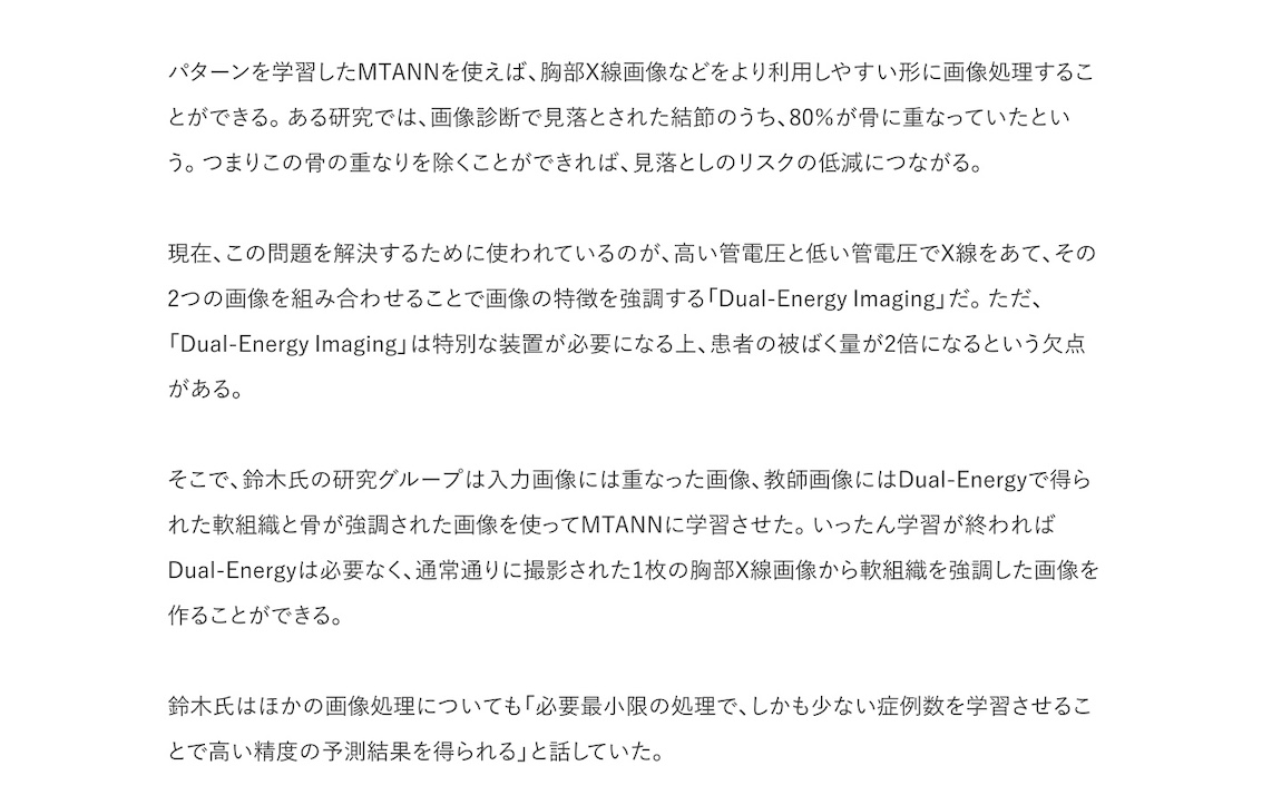 鈴木教授の講演がm3.comで特集されました