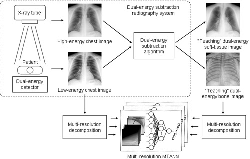 Virtual Dual-Energy Radiography: Image-Processing Technique for Suppressing Ribs in Chest Radiographs by Means of Massive-Training Artificial Neural Network (MTANN)