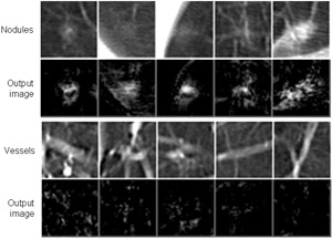 Computerized Detection of Lung Nodules in Low-Dose CT, Part I: Basic Principle of Massive-Training Artificial Neural Network (MTANN) for Reduction of False Positives