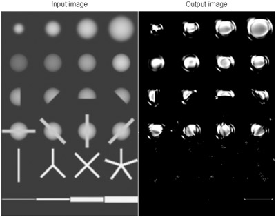 Massive-Training Artificial Neural Network (MTANN) Trained with a Small Number of Cases for Enhancement of Nodules and Suppression of Vessels in Thoracic CT: Phantom Experiments